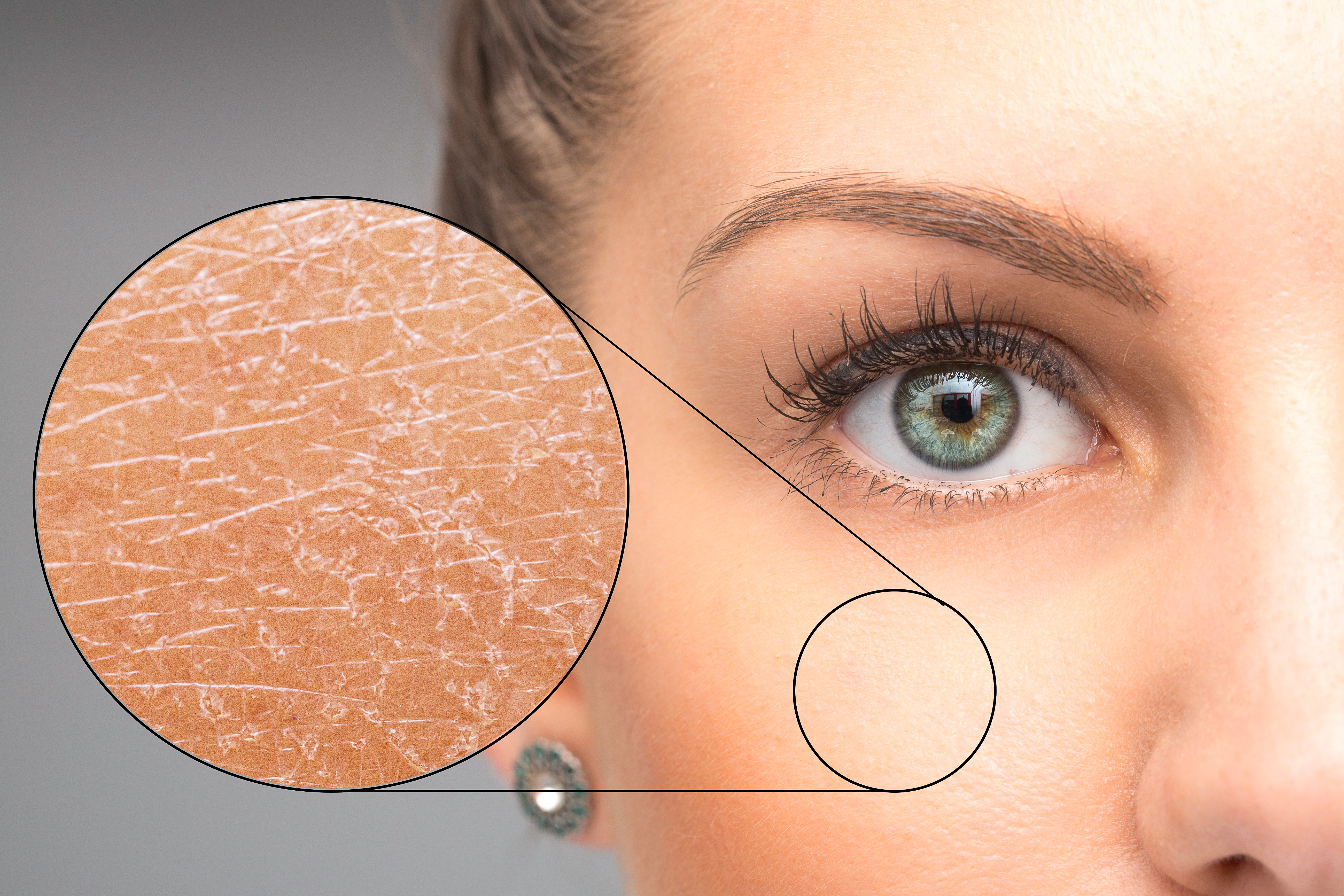 Bí quyết nuôi dưỡng làn da mềm mại trong mùa đông