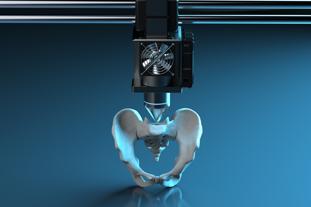 Ứng dụng công nghệ 3D trong chấn thương chỉnh hình