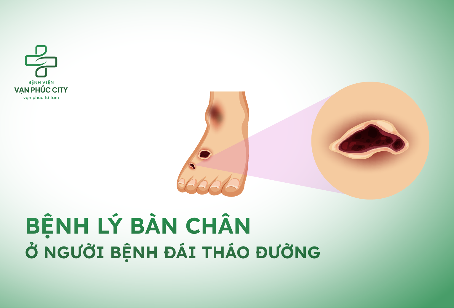 BÀN CHÂN ĐÁI THÁO ĐƯỜNG - BIẾN CHỨNG NGUY HIỂM VÀ CÁCH NGĂN NGỪA HIỆU QUẢ