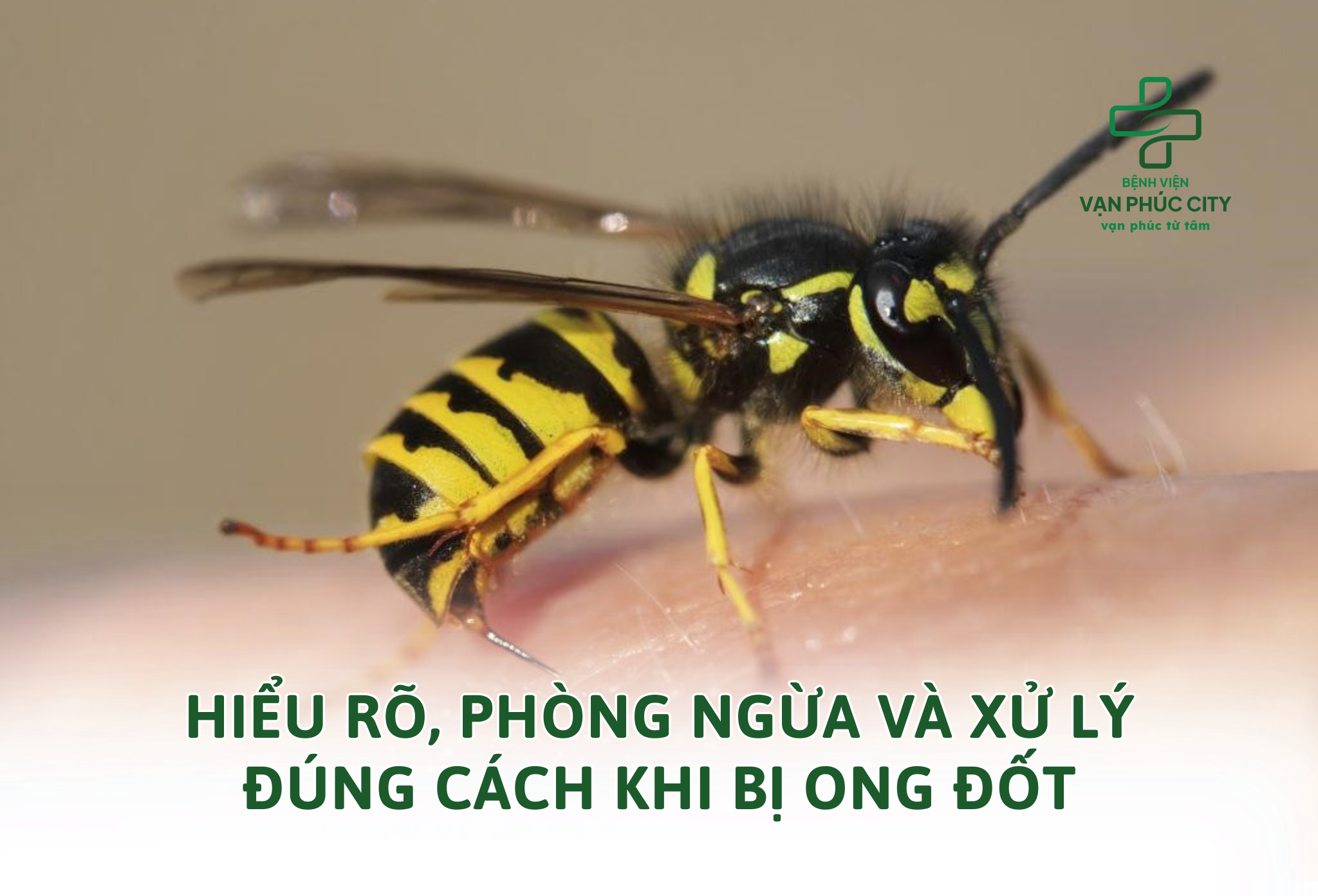 HIỂU RÕ, PHÒNG NGỪA VÀ XỬ LÝ ĐÚNG CÁCH KHI BỊ ONG ĐỐT