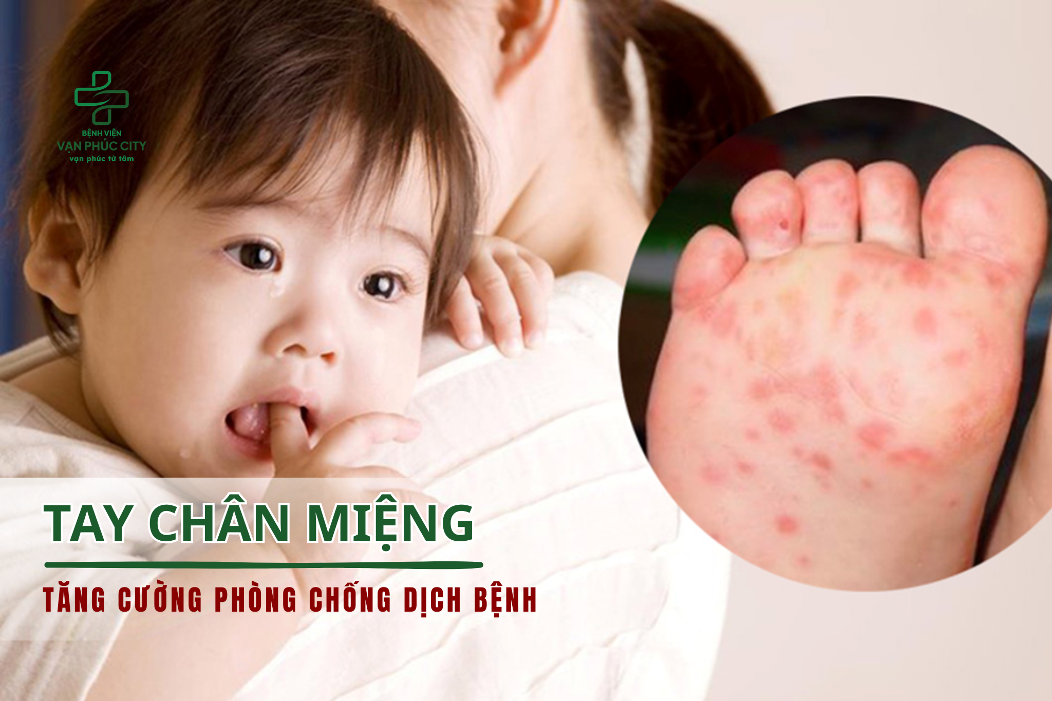 TĂNG CƯỜNG BIỆN PHÁP PHÒNG, CHỐNG BỆNH TAY CHÂN MIỆNG