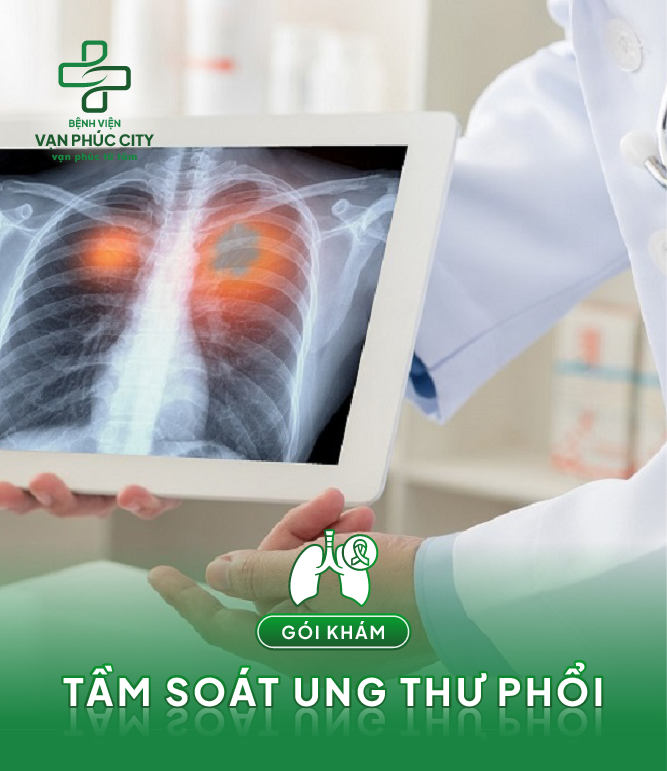 Gói khám tầm soát ung thư phổi